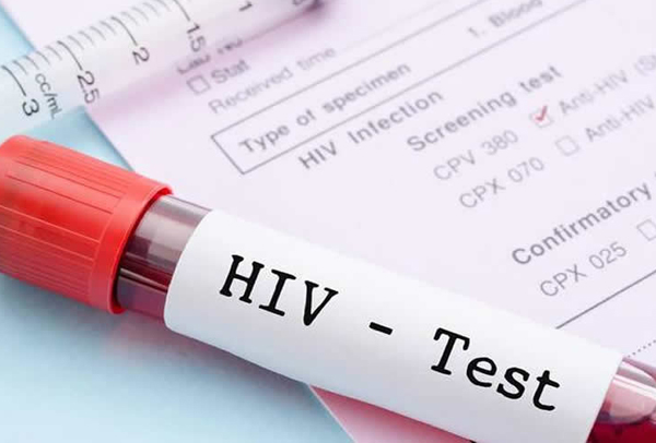 Salud Estudiantil reforzará campaña sobre prevención de VIH